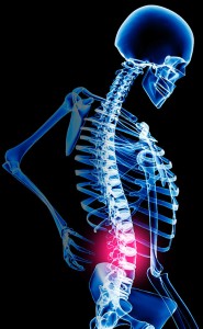 back pain 185x300 - Knee and Back pain – it’s just a pain in the butt!