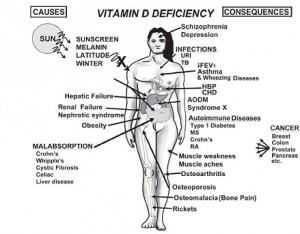 vitamin d deficiency 300x234 - Vitamin D - How Natural Sunlight Can Improve Your Health